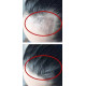 Sérum traitement capillaire cheveux Anti-perte de cheveux repousse cheveux 2x30ML6