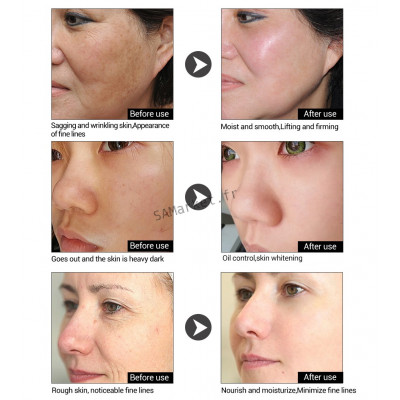 Sérum Multiple Anti-âge Acide hyaluronique OR 24 Carat 6 Peptides Traitement Acné Hydratant Resserre les pores Raffermit la peau 15ml7
