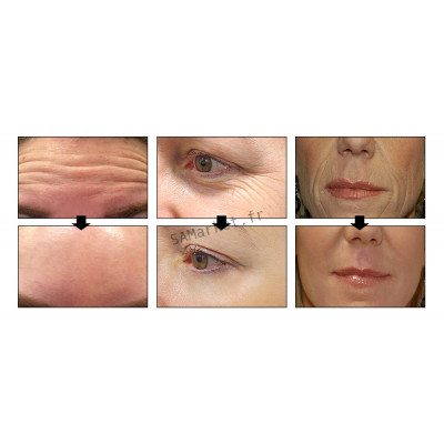 Sérum Multiple Anti-âge Acide hyaluronique OR 24 Carat 6 Peptides Traitement Acné Hydratant Resserre les pores Raffermit la peau 15ml10