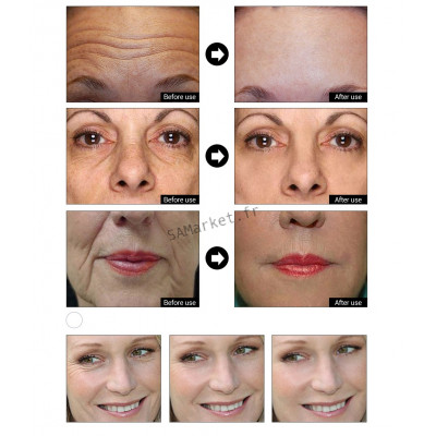Sérum Multiple Anti-âge Acide hyaluronique OR 24 Carat 6 Peptides Traitement Acné Hydratant Resserre les pores Raffermit la peau 15ml11