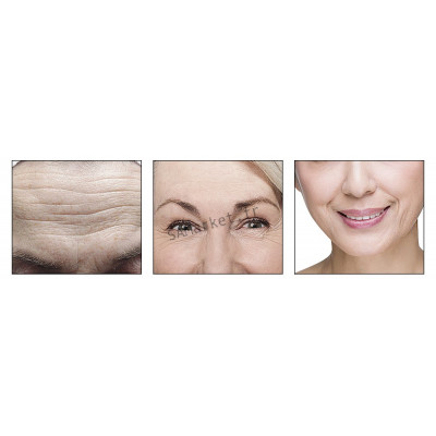 Sérum Multiple Anti-âge Acide hyaluronique OR 24 Carat 6 Peptides Traitement Acné Hydratant Resserre les pores Raffermit la peau 15ml8