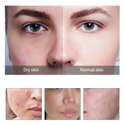 Sérum Multiple Anti-âge Acide hyaluronique OR 24 Carat 6 Peptides Traitement Acné Hydratant Resserre les pores Raffermit la peau 15ml6