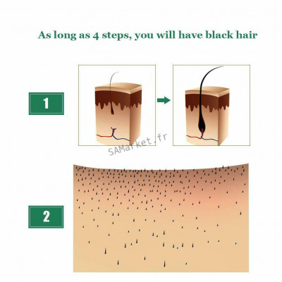 Sérum de repousse des cheveux naturel au gingembre efficace contre la perte de cheveux croissance rapide soin capillaire5