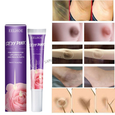 Crème blanchissante pour les lèvres et les parties intimes pour femme soins pour la peau partie privée rose2